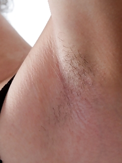 Hairy Female Alice L Looks Charming In Her Yellow Striped Miniskirt